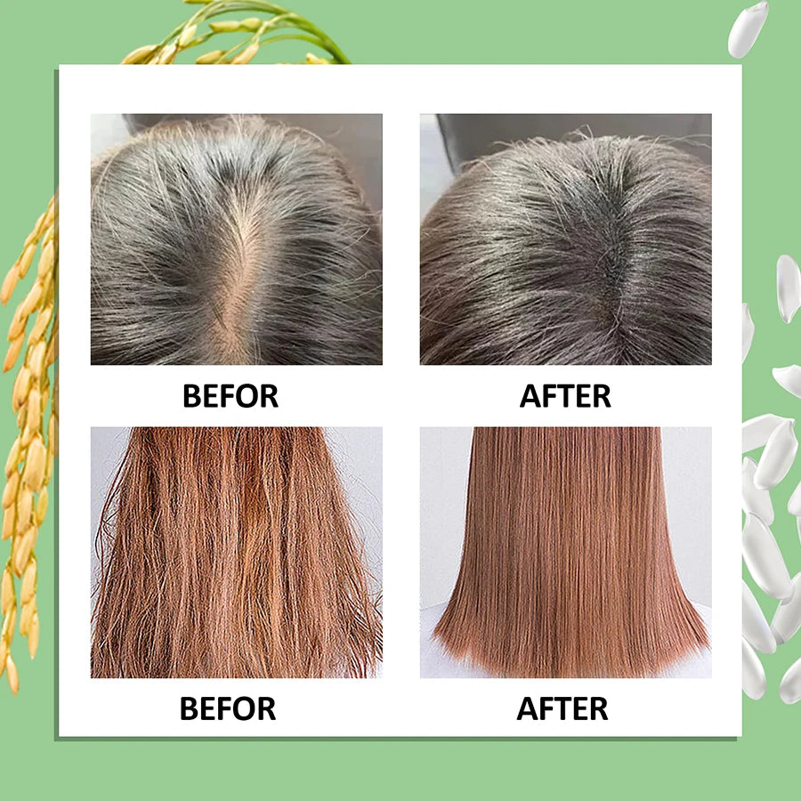 Rice Water Hair Growth Spray